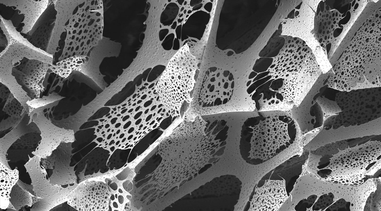 SEM images of flower arrangement foam where the microstructure can be seen
